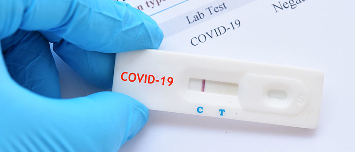 coronavirus, new, wuhan, hubei, china, sars-cov-2, virus, laboratory, flu, genome, pcr, epidemic, blood, mers, disease, covid-19, research, negative, reactive, positive, molecular, analyzing, test, rapid, cassette, kit, device, machine, syndrome, cov, exam, 19, infection, severe, sample, simple, covid, health, care, respiratory, pneumonia, diagnosis, 2019, ncov, sars, corona, novel, 2, acute